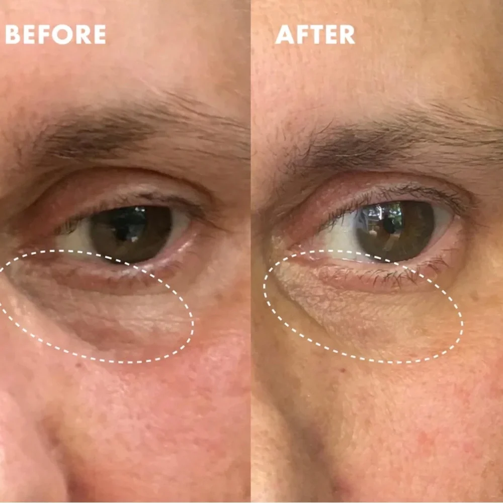 NEW Kopari Niacinamide & Caffeine Eye Bright Cream Wrinkles Crows Feet Eye Cream